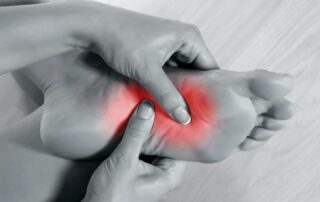 do arch supports help neuropathy burning feet